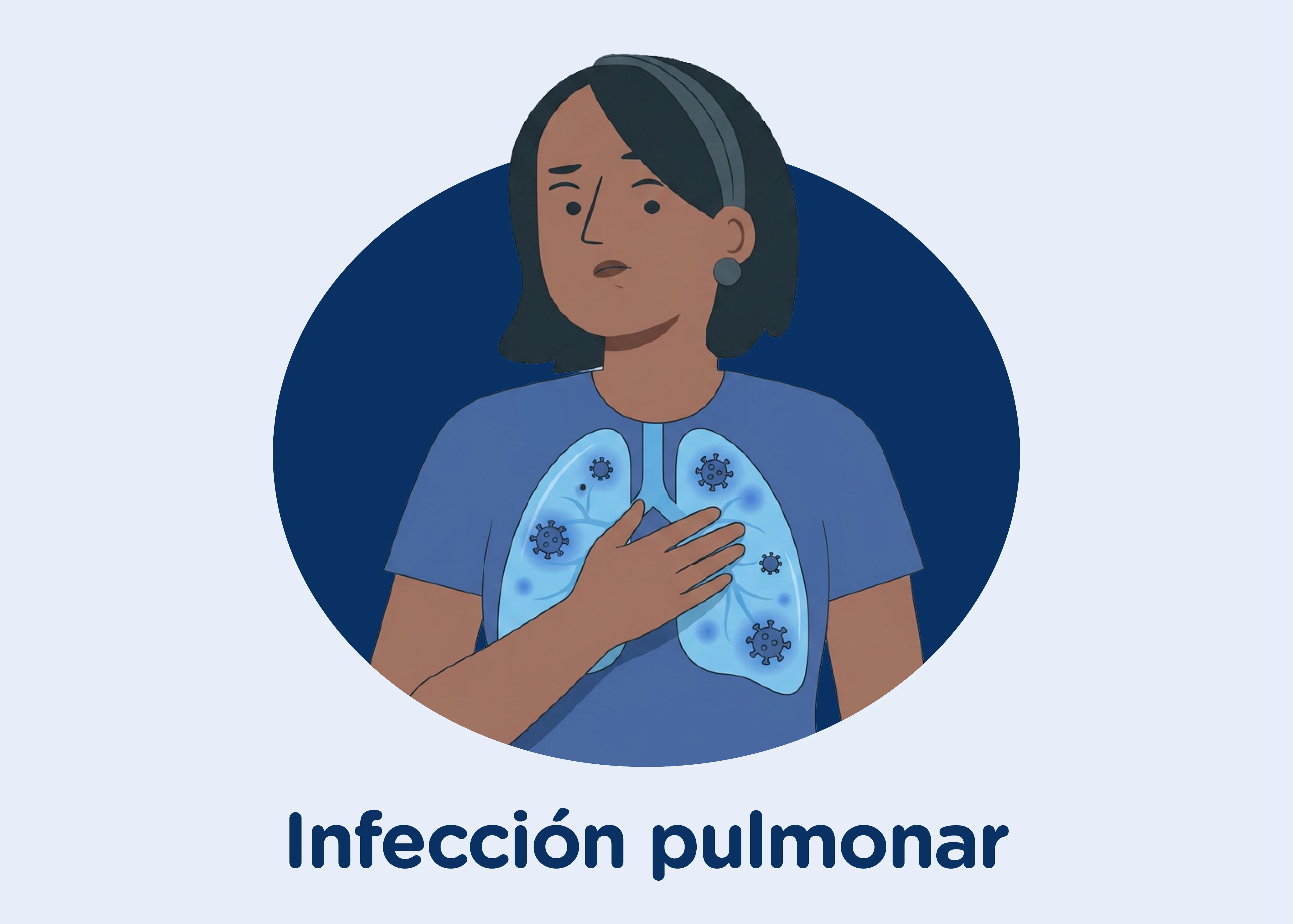 Neumonía como complicación grave del sarampión en menores de 5 años