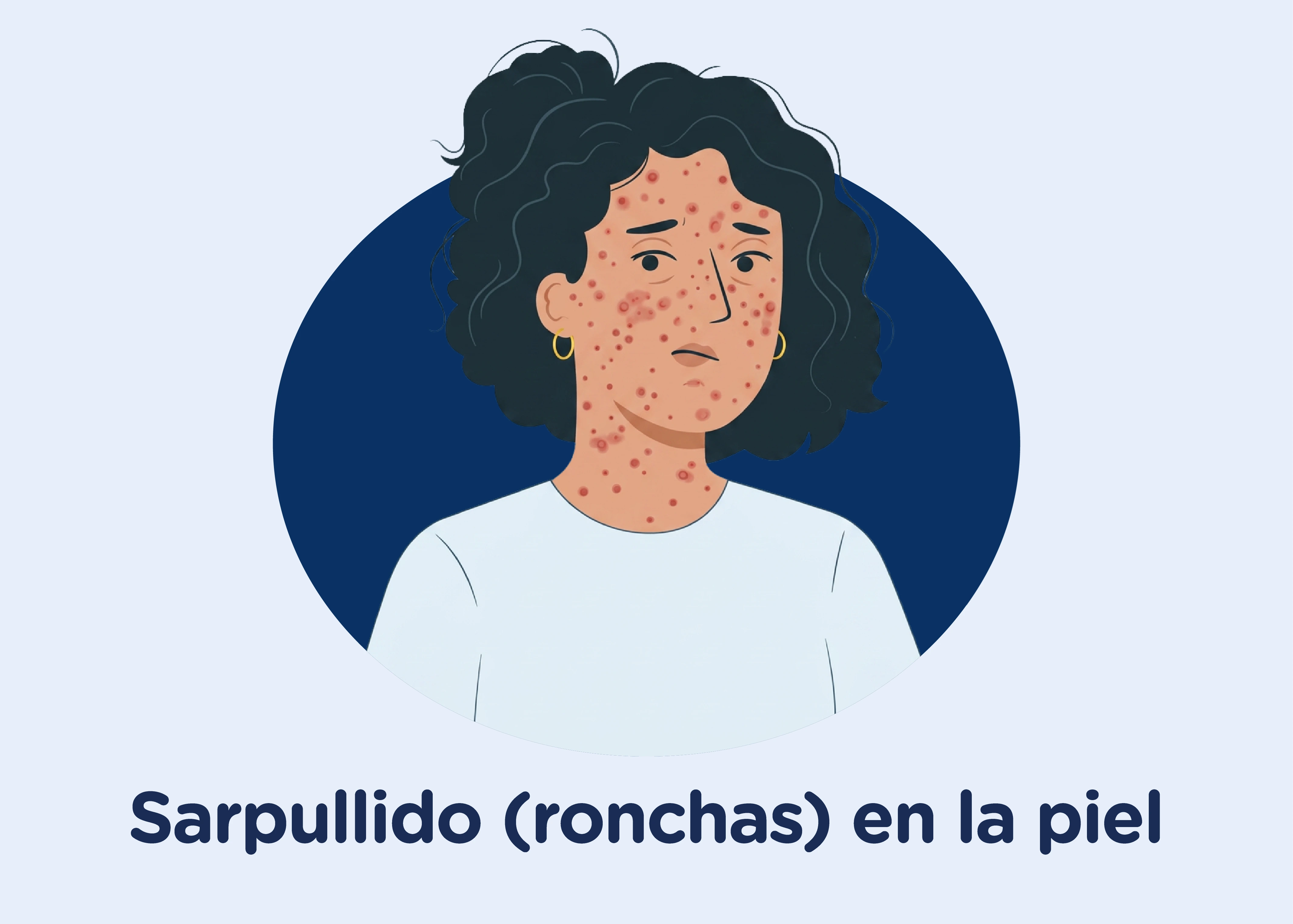 Sarpullido y ronchas rojas en piel por sarampión